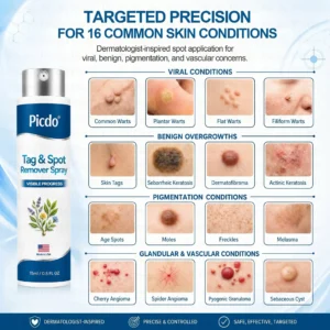 𝐏𝑖𝐜𝐝𝑜® 7-𝐷𝑎𝑦 𝑇𝑎𝑔 & 𝑆𝑝𝑜𝑡 𝑅𝑒𝑚𝑜𝑣𝑒𝑟 𝑆𝑝𝑟𝑎𝑦(Zero Pain, Zero 𝐒𝐜𝐚𝒓𝒔 Precision Spray)🍁
