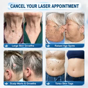📢𝐏i𝐜𝐝o® 7-𝐷𝑎𝑦 𝗧𝐚𝐠 & 𝗦𝗽𝐨𝐭 𝐄𝐫𝒂𝒔𝒆𝒓(Zero Pain, Zero 𝐒𝐜𝐚𝒓𝒔 Rollerball)
 – healthylivingmedicalcenter